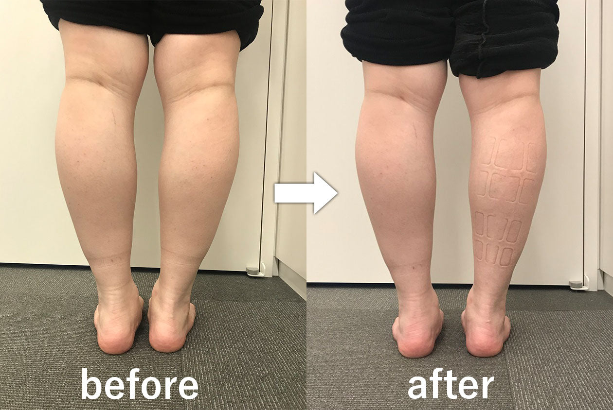 スタイリーレッグ