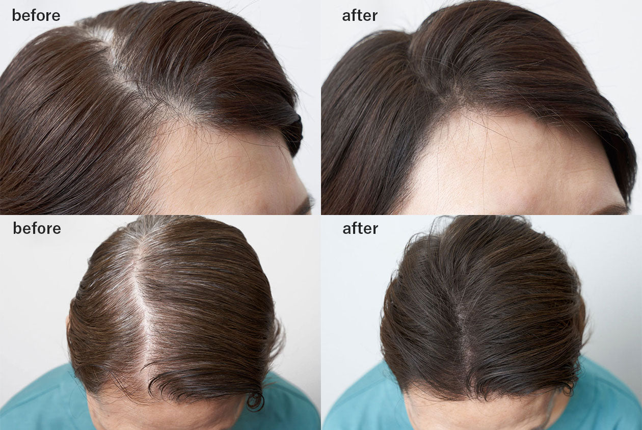 ＜ララチュー＞ ヘアファンデーションプレミアムN