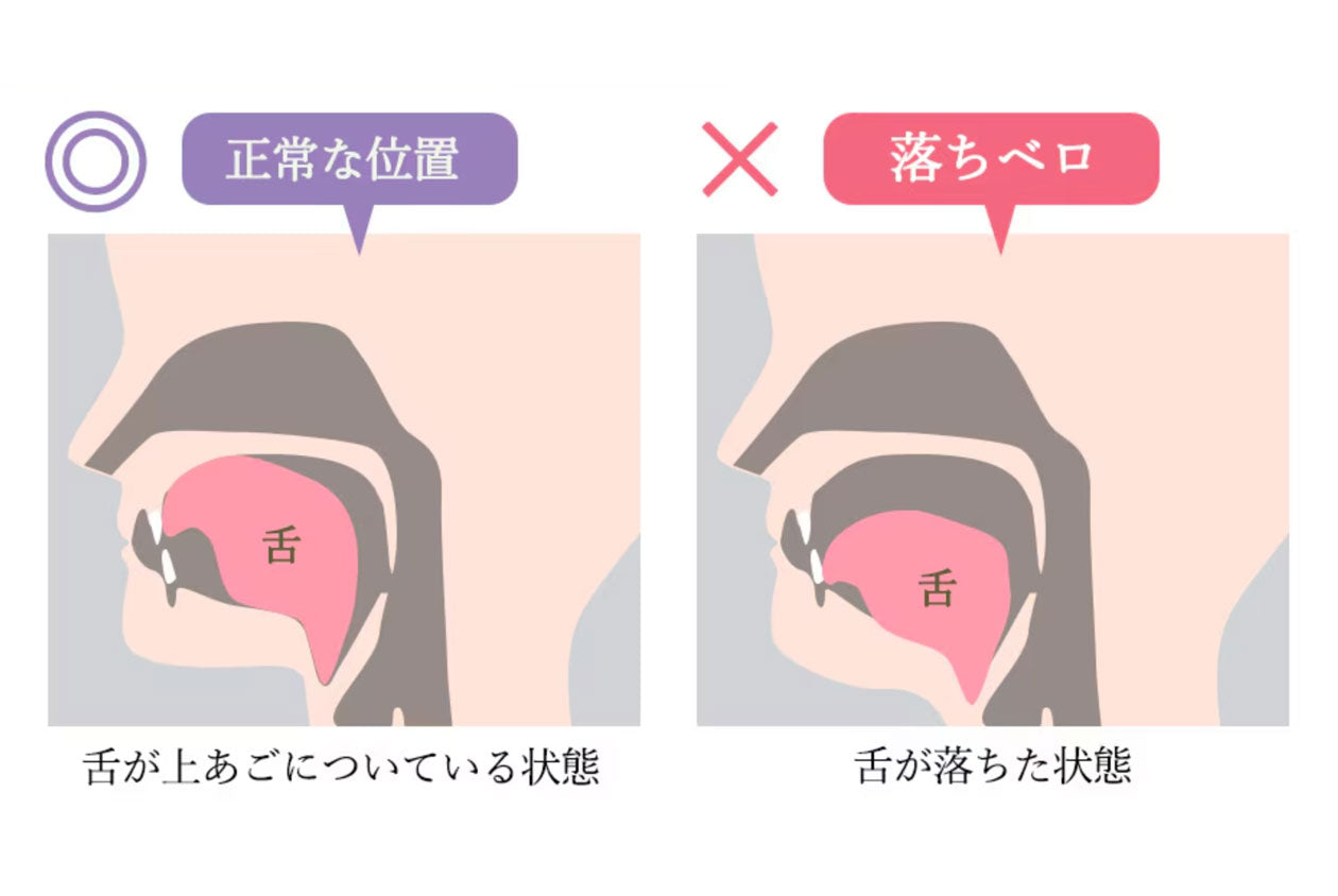 スタイリーフェイス