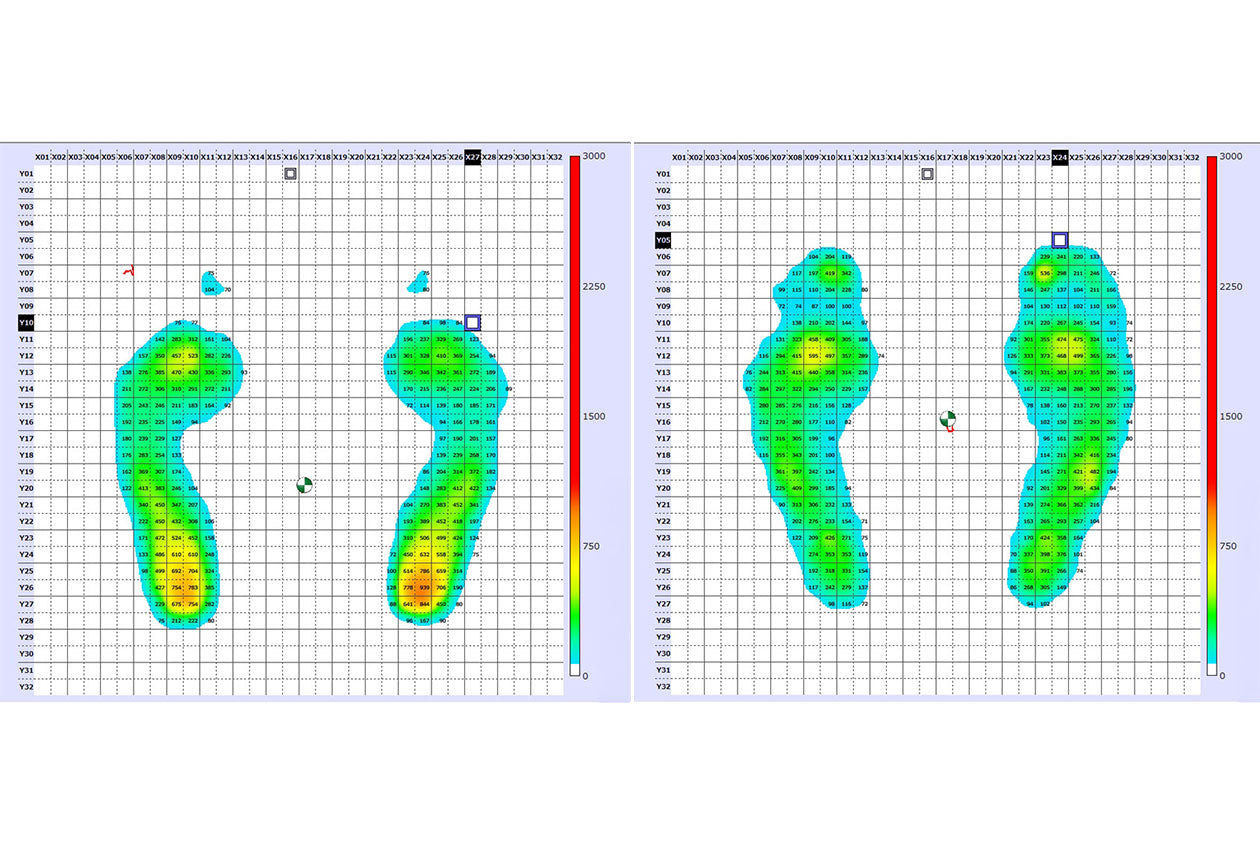 ムテキインソール